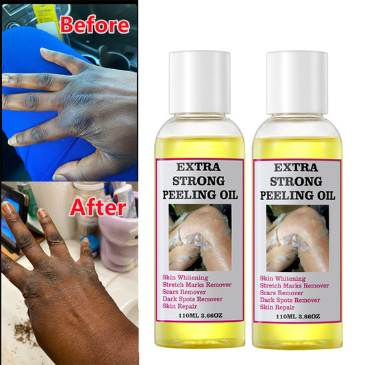 EXTRA STRONG PEELING OIL-Huile qui élimine les quintos,taches,mamies et cicatrices