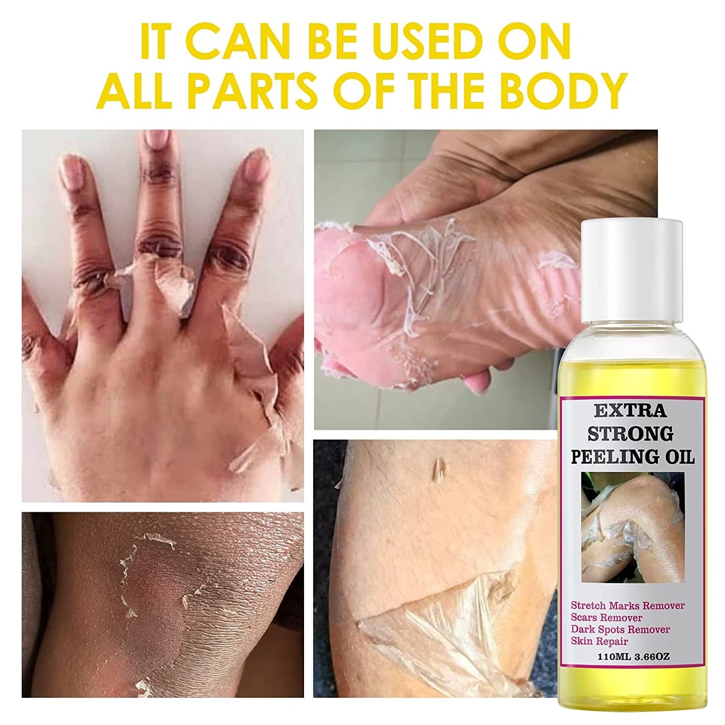 EXTRA STRONG PEELING OIL-Huile qui élimine les quintos,taches,mamies et cicatrices