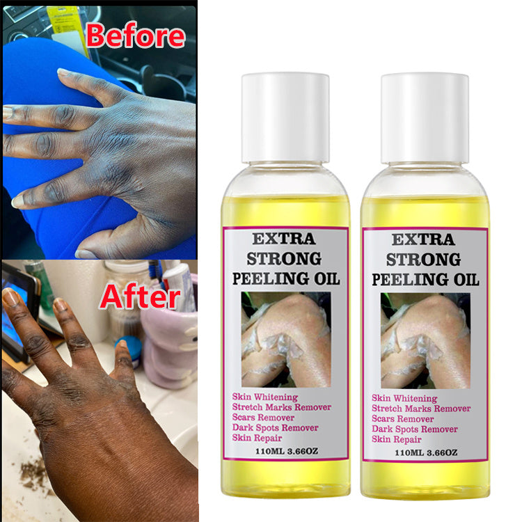 EXTRA STRONG PEELING OIL-Huile qui élimine les quintos,taches,mamies et cicatrices