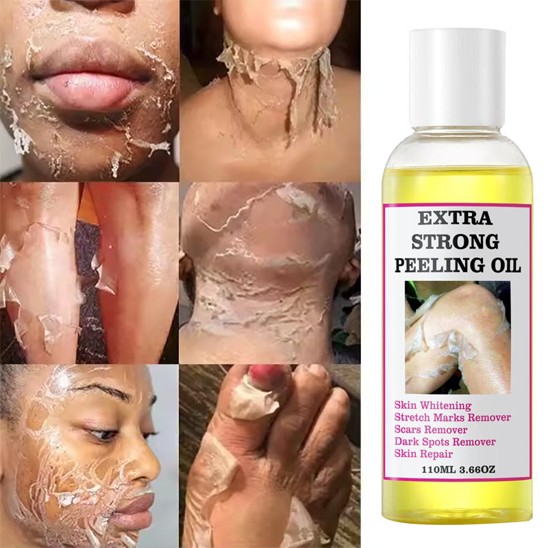 EXTRA STRONG PEELING OIL-Huile qui élimine les quintos,taches,mamies et cicatrices