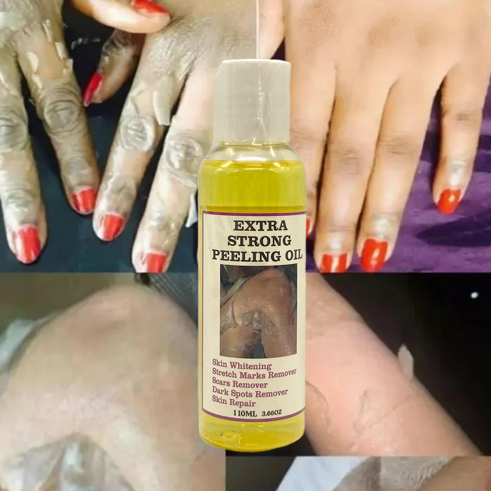 EXTRA STRONG PEELING OIL-Huile qui élimine les quintos,taches,mamies et cicatrices