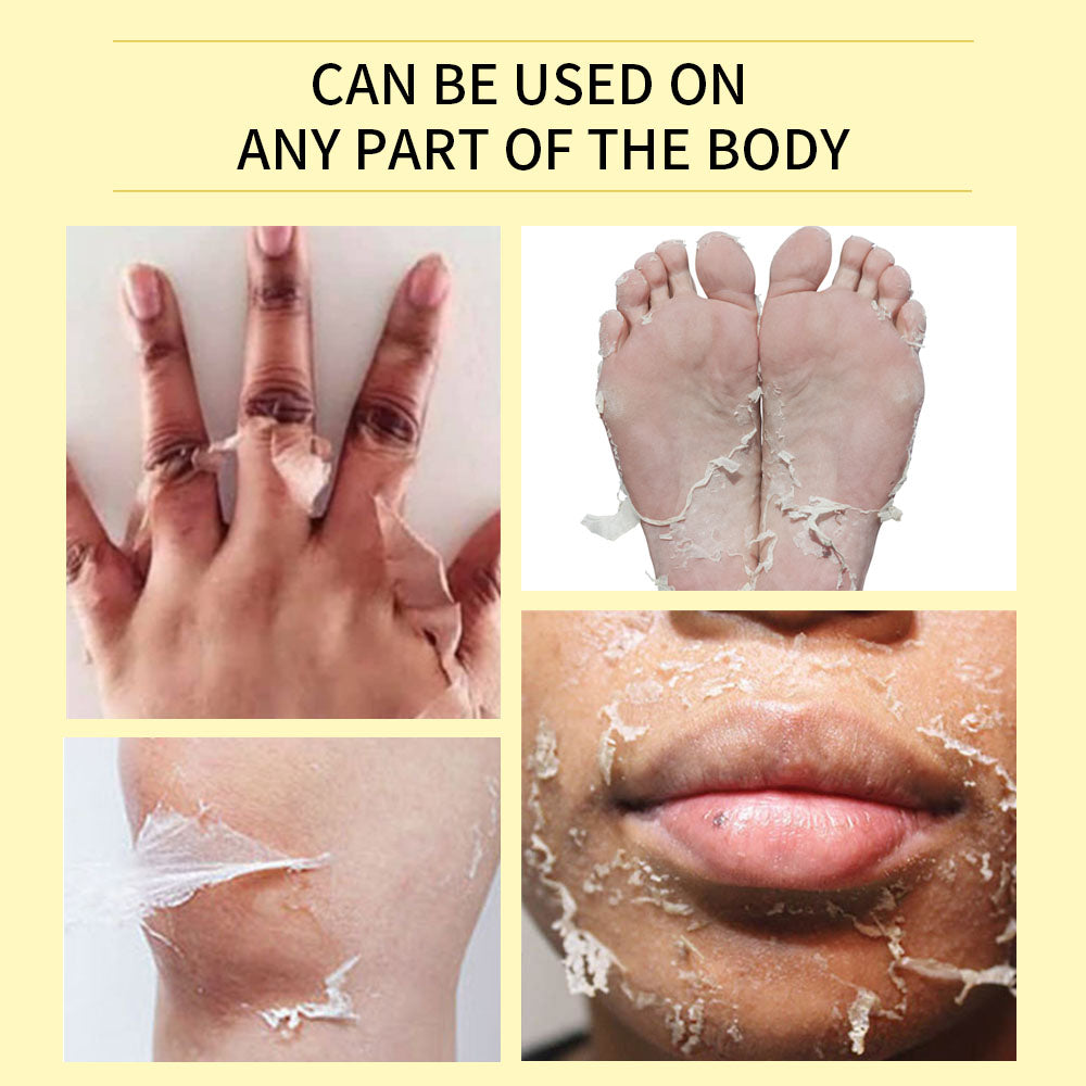 EXTRA STRONG PEELING OIL-Huile qui élimine les quintos,taches,mamies et cicatrices