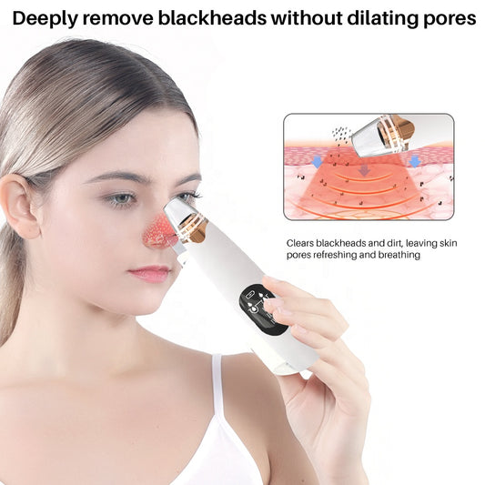 Nettoyeur de visage électrique chargeable & Extracteur Professionnelle des Pores et points noirs