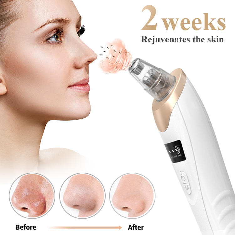 Nettoyeur de visage électrique chargeable & Extracteur Professionnelle des Pores et points noirs