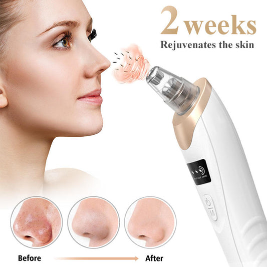 Nettoyeur de visage électrique chargeable & Extracteur Professionnelle des Pores et points noirs