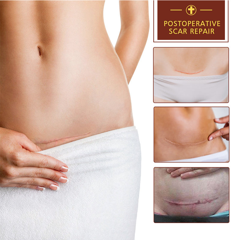 CREME REPARATRICE ORIGINALE Pei Mei ANTI-CICATRICES,BRULURES,VERGETURES