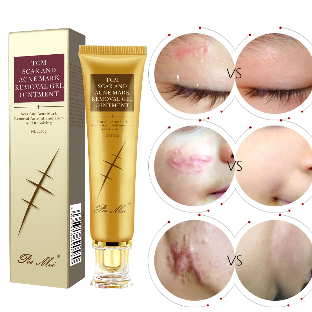 CREME REPARATRICE ORIGINALE Pei Mei ANTI-CICATRICES,BRULURES,VERGETURES