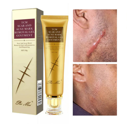 GEL REPARATRICE DE CICATRICE,VERGETURE,TACHE & ACNE TCM SCAR Pei Mei